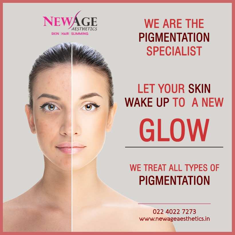 Pigmentation skin lightening treatments andheri