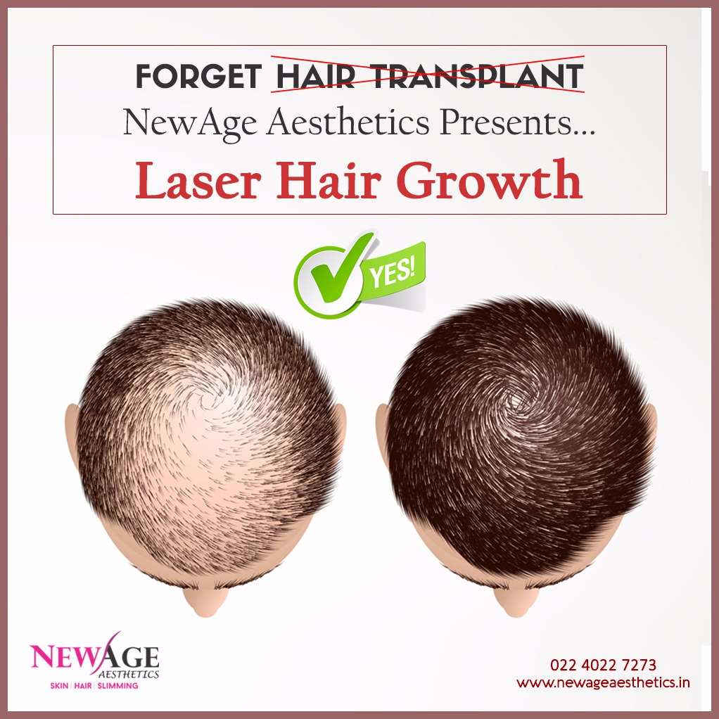 low level laser therapy for hair growth