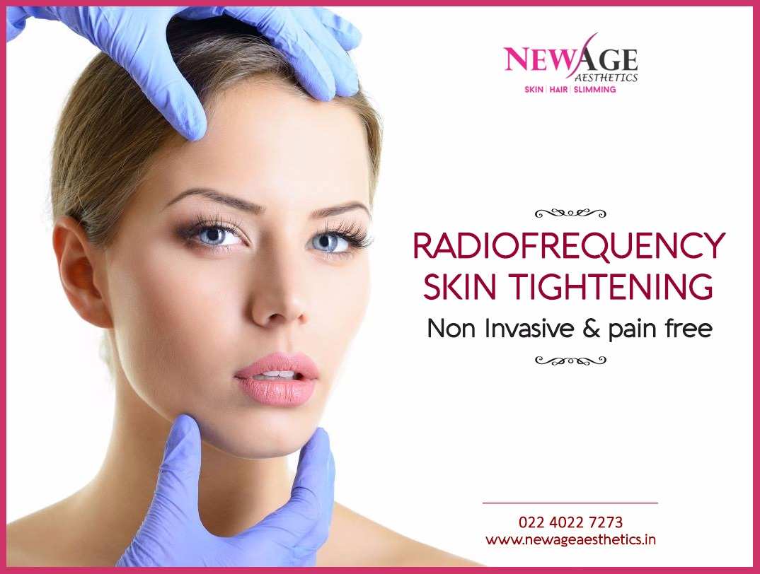 Radiofrequency skin tightening